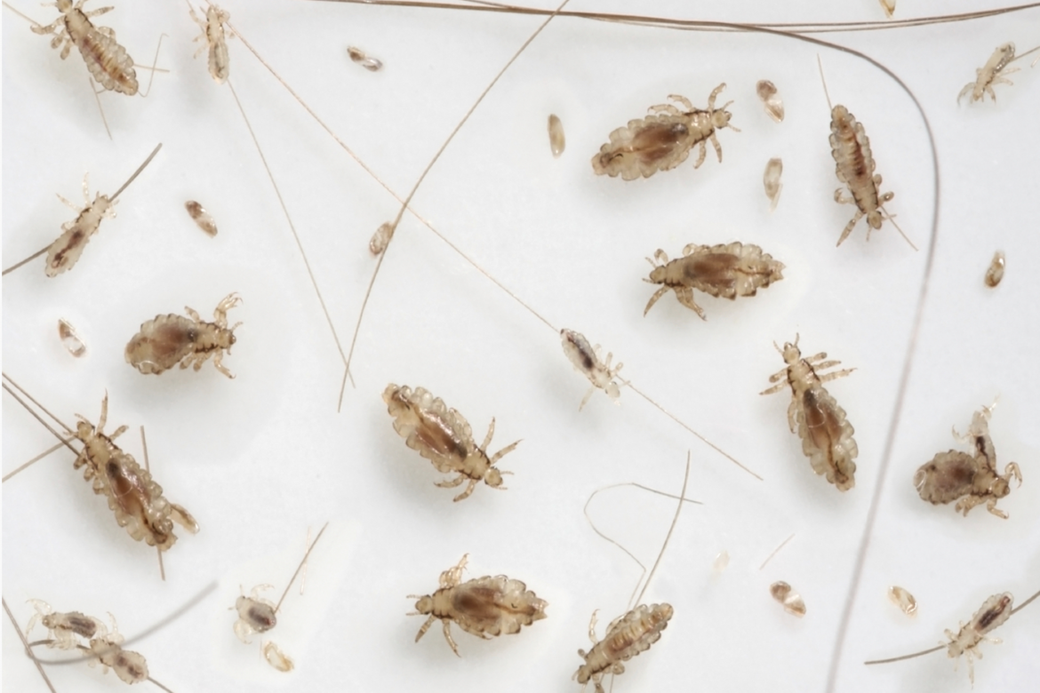 Head Lice Prevention and Treatment