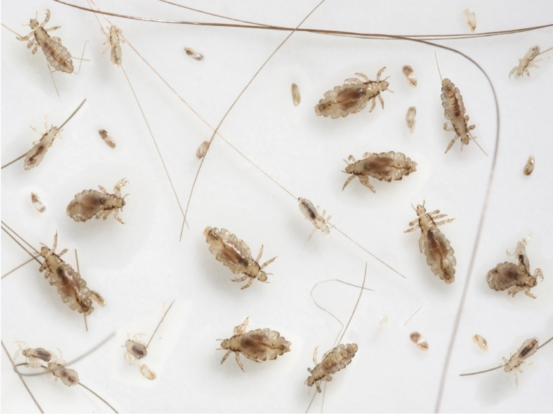Head Lice Prevention and Treatment - Aantex